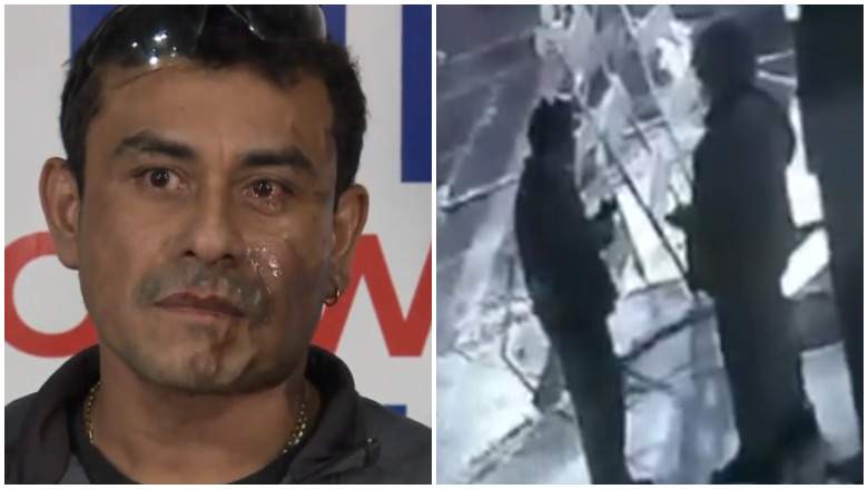 Mahud Villalaz: ¿Por qué lo atacaron con ácido?VIDEO