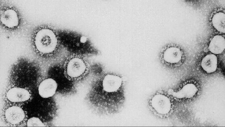 Cuáles son las condiciones subyacentes del coronavirus?