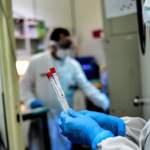 Segundos cheques de estÃ­mulo & Coronavirus: Noticias de Agosto 27