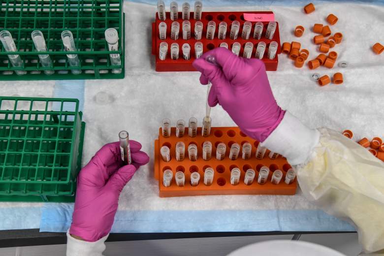 Un técnico de laboratorio clasifica muestras de sangre para el estudio de vacunación COVID-19 en los Centros de Investigación de América en Hollywood, Florida, el 13 de agosto de 2020
