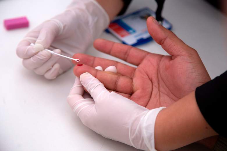 Test de HIV