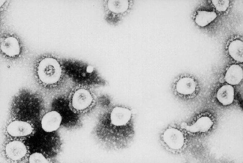 Esta foto sin fecha de los Centros para el Control y la Prevención de Enfermedades (CDC) muestra una vista microscópica del coronavirus en los CDC en Atlanta, Georgia.