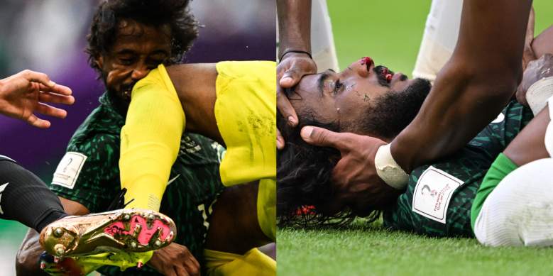 Al Shahrani sufre una grave lesión en el partido contra Arabia Saudita