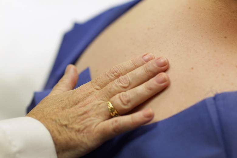 Vacuna de Moderna contra el cáncer de piel da buenos resultados iniciales