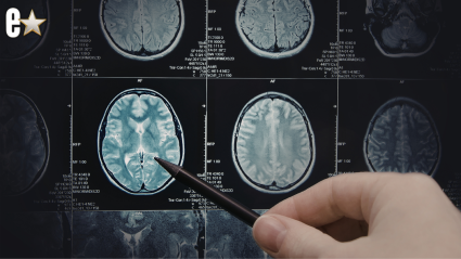 La estrella de 'Gran Hermano' revela que sufrió un derrame cerebral