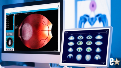 Una estrella de la telerrealidad revela que perdió la vista en un ojo durante una terrible experiencia de salud.