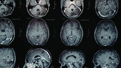 Una querida estrella del rock de los 90 habla abiertamente sobre su último revés de salud tras cinco años de lucha contra el cáncer.